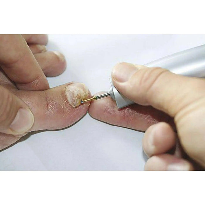 1SXM Tungsten carbide bur - Enucleation of corns - 2.1 mm - My Podology