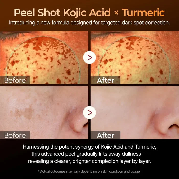 Dr. Melaxin Peel Shot Exfoliating Kojic Acid Turmeric Serum 80Ml