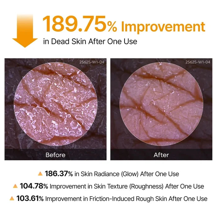 Dr. Melaxin Peel Shot Exfoliating Kojic Acid Turmeric Spray 200Ml