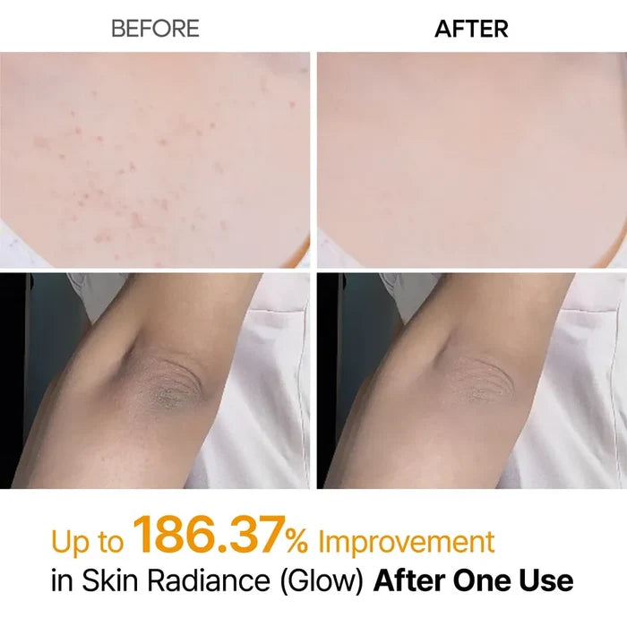 Dr. Melaxin Peel Shot Exfoliating Kojic Acid Turmeric Spray 200Ml