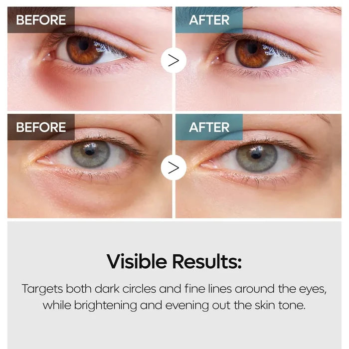 Dr. Melaxin TX Retinalsome Double Effect Eye Cream 40g